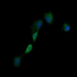 anti-Epidermal Growth Factor Receptor (EGFR) antibody