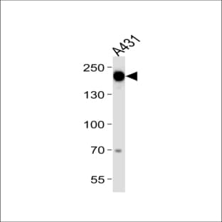 anti-Epidermal Growth Factor Receptor (EGFR) (Tyr1092), (AA 1070-1099) antibody