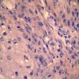 anti-Epidermal Growth Factor Receptor (EGFR) (Tyr1173) antibody