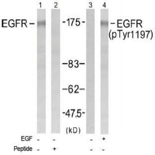 anti-Epidermal Growth Factor Receptor (EGFR) (Tyr 1197) antibody
