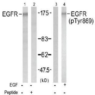 anti-Epidermal Growth Factor Receptor (EGFR) (Tyr 869) antibody