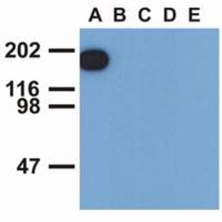 anti-Epidermal Growth Factor Receptor (EGFR) (Tyr1173), (pTyr1173) antibody