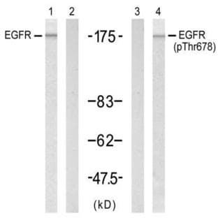 anti-Epidermal Growth Factor Receptor (EGFR) antibody