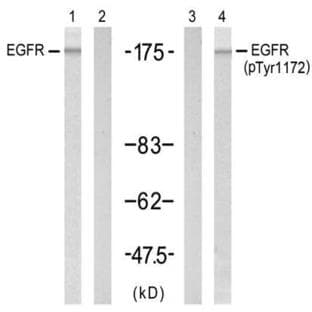 anti-Epidermal Growth Factor Receptor (EGFR) antibody