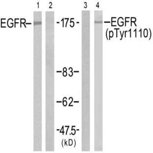 anti-Epidermal Growth Factor Receptor (EGFR) antibody avatar