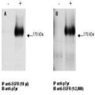 anti-Epidermal Growth Factor Receptor (EGFR) antibody avatar