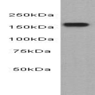 anti-Epidermal Growth Factor Receptor (EGFR) antibody avatar