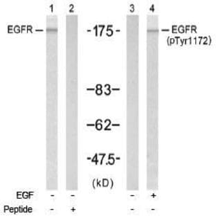 anti-Epidermal Growth Factor Receptor (EGFR) (Tyr 1172) antibody