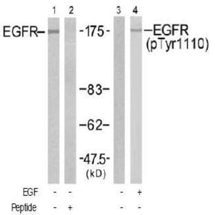 anti-Epidermal Growth Factor Receptor (EGFR) (Tyr 1110) antibody