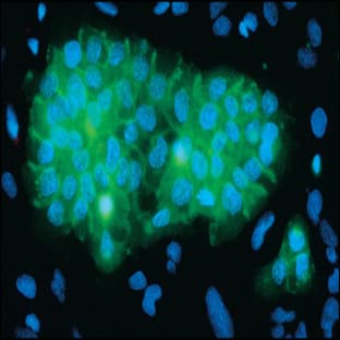 anti-Epidermal Growth Factor Receptor (EGFR) antibody