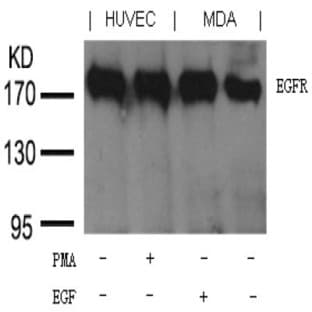 anti-Epidermal Growth Factor Receptor (EGFR) (Tyr1197) antibody