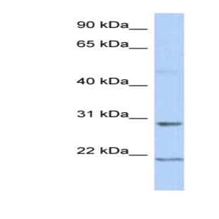 anti-Chromosome 12 Open Reading Frame 53 (C12orf53) (Middle Region) antibody avatar