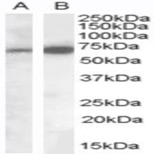 anti-Cell Adhesion Molecule 4 (CADM4) (Internal Region) antibody avatar