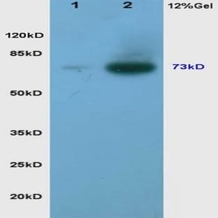 anti-CREB Regulated Transcription Coactivator 2 (CRTC2) (pSer171) antibody avatar