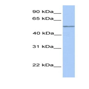 anti-Chromosome 17 Open Reading Frame 74 (C17orf74) (Middle Region) antibody avatar