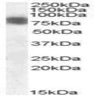 anti-Cortactin (CTTN) (N-Term) antibody avatar