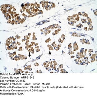 anti-Empty Spiracles Homeobox 2 (EMX2) (N-Term) antibody