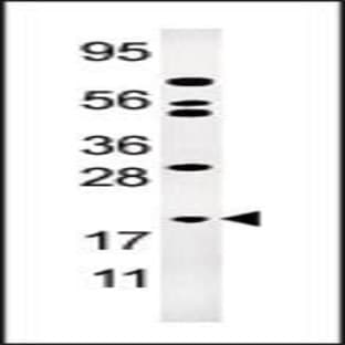 anti-Adenylate Kinase 1 (AK1) (N-Term) antibody avatar