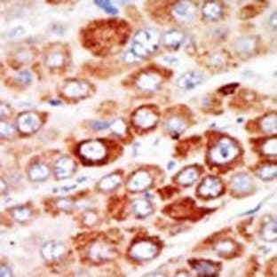 anti-Adenylate Kinase 1 (AK1) (C-Term) antibody avatar