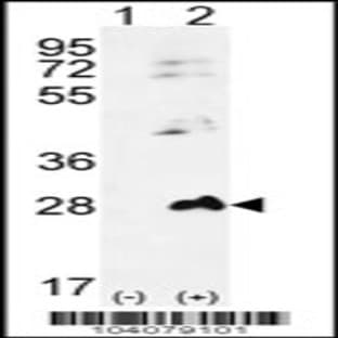 anti-Adenylate Kinase 1 (AK1) (N-Term), (AA 30-59) antibody avatar