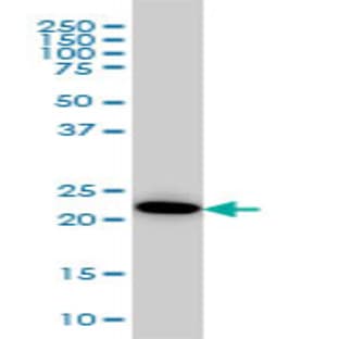 anti-Adenylate Kinase 1 (AK1) (AA 1-195) antibody avatar