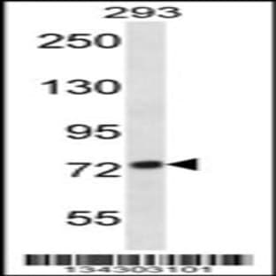 anti-ADAM Metallopeptidase Domain 32 (ADAM32) (N-Term), (AA 141-169) antibody avatar