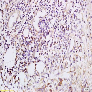 anti-Chemokine (C-X-C Motif) Ligand 5 (CXCL5) antibody avatar