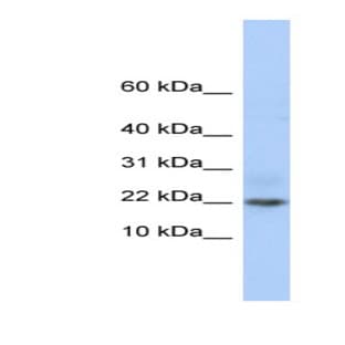 anti-Chromosome 9 Open Reading Frame 25 (C9orf25) (Middle Region) antibody avatar