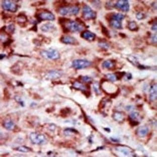 anti-Adenylate Kinase 2 (AK2) (C-Term) antibody avatar