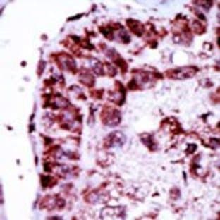 anti-Adenylate Kinase 2 (AK2) (N-Term) antibody avatar