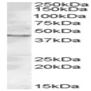 anti-Ceramide Synthase 3 (CERS3) (C-Term) antibody avatar