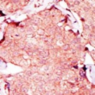 anti-Adenylate Kinase 4 (AK4) (C-Term) antibody avatar