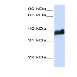 anti-Ceroid-Lipofuscinosis, Neuronal 8 (Epilepsy, Progressive with Mental Retardation) (CLN8) (N-Term) antibody