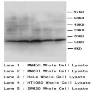 anti-Somatostatin (SST) (AA 1-14) antibody avatar