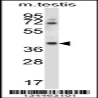 anti-Casein Kinase 1, gamma 1 (CSNK1G1) (C-Term), (AA 359-387) antibody avatar