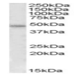 anti-Coagulation Factor II (thrombin) Receptor (F2R) (Internal Region) antibody avatar