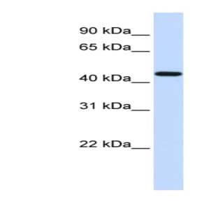 anti-Coagulation Factor II (thrombin) Receptor (F2R) (N-Term) antibody avatar