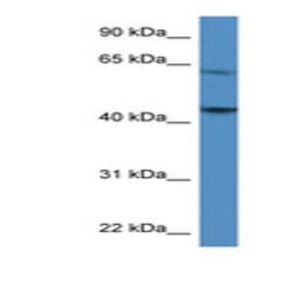 anti-Coagulation Factor II (thrombin) Receptor (F2R) (C-Term) antibody avatar
