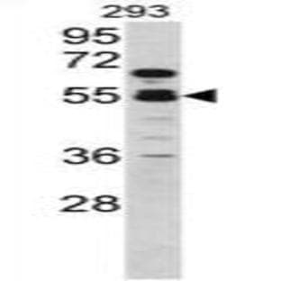 anti-Coagulation Factor X (F10) (C-Term) antibody avatar