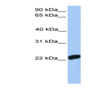 anti-Coagulation Factor X (F10) (C-Term) antibody avatar