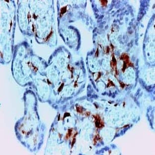 anti-Coagulation Factor XIII, A1 Polypeptide (F13A1) antibody avatar