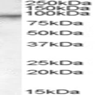 anti-Coagulation Factor XIII, A1 Polypeptide (F13A1) (Internal Region) antibody avatar