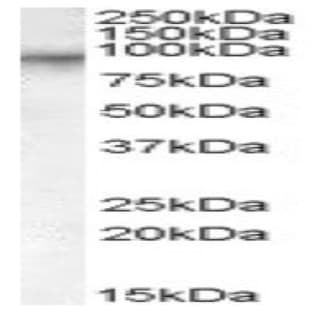 anti-Coagulation Factor XIII, A1 Polypeptide (F13A1) (Internal Region), (AA 703-717) antibody avatar