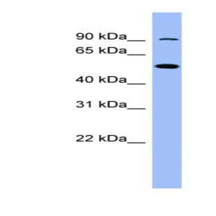 anti-Coagulation Factor XIII B Polypeptide (F13B) (N-Term) antibody avatar