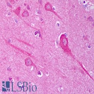 anti-AHA1, Activator of Heat Shock 90kDa Protein ATPase Homolog 1 (Yeast) (AHSA1) antibody avatar