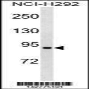 anti-Acyl-CoA Synthetase Long-Chain Family Member 1 (Acsl1) (C-Term), (AA 505-533) antibody avatar