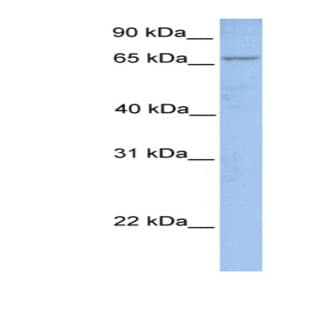 anti-Acyl-CoA Synthetase Long-Chain Family Member 1 (Acsl1) (N-Term) antibody avatar