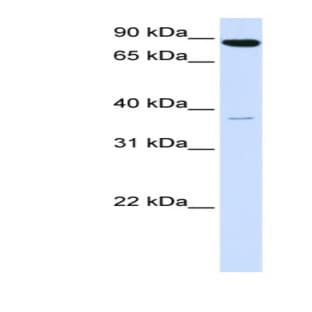 anti-Acyl-CoA Synthetase Long-Chain Family Member 3 (Acsl3) (N-Term) antibody avatar