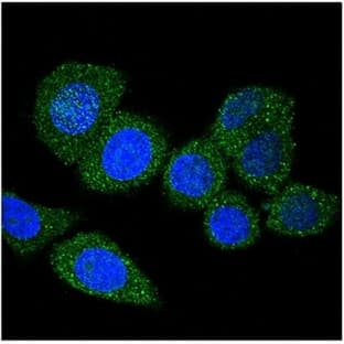 anti-Acyl-CoA Synthetase Long-Chain Family Member 4 (ACSL4) (AA 244-274) antibody avatar