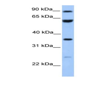 anti-Coiled-Coil Domain Containing 7 (CCDC7) (N-Term) antibody avatar